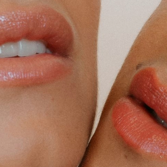 De beste lip treatments