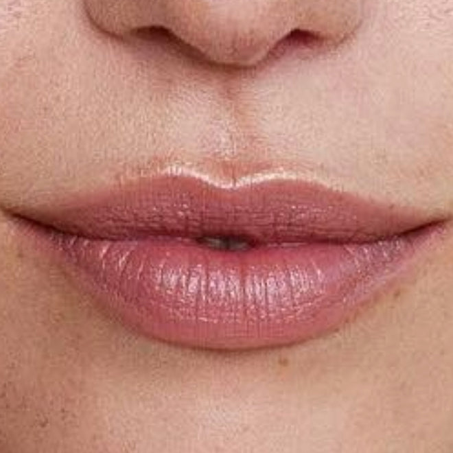 Lip lift