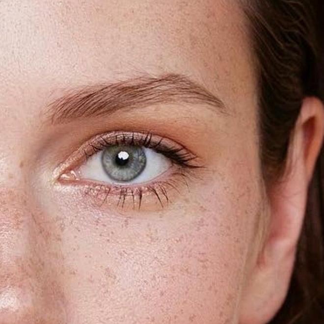 Brow lift