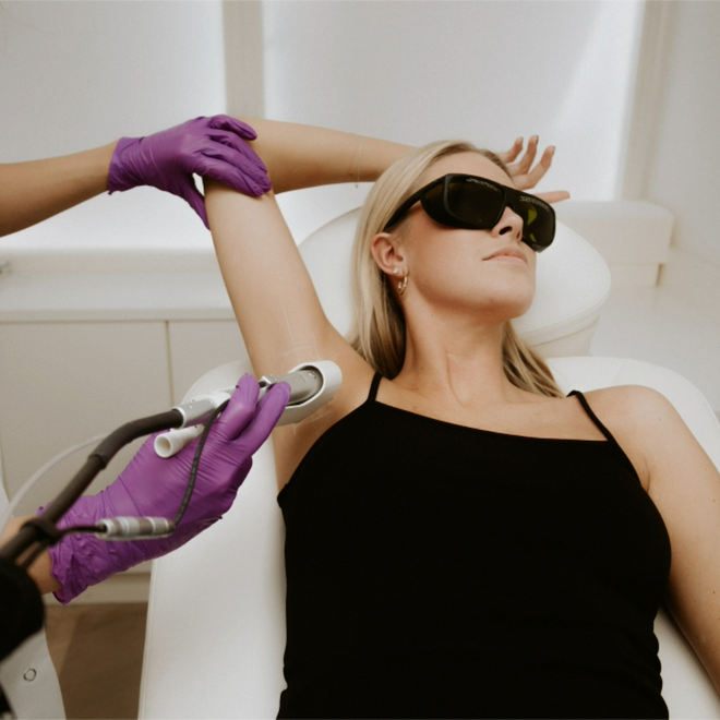 hair removal laser treatment
