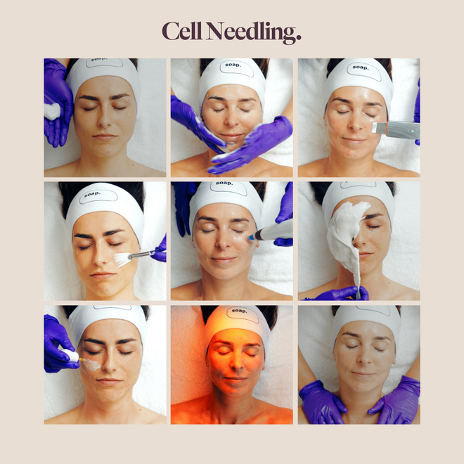 NIEUW: Cell needling + LED light Therapy